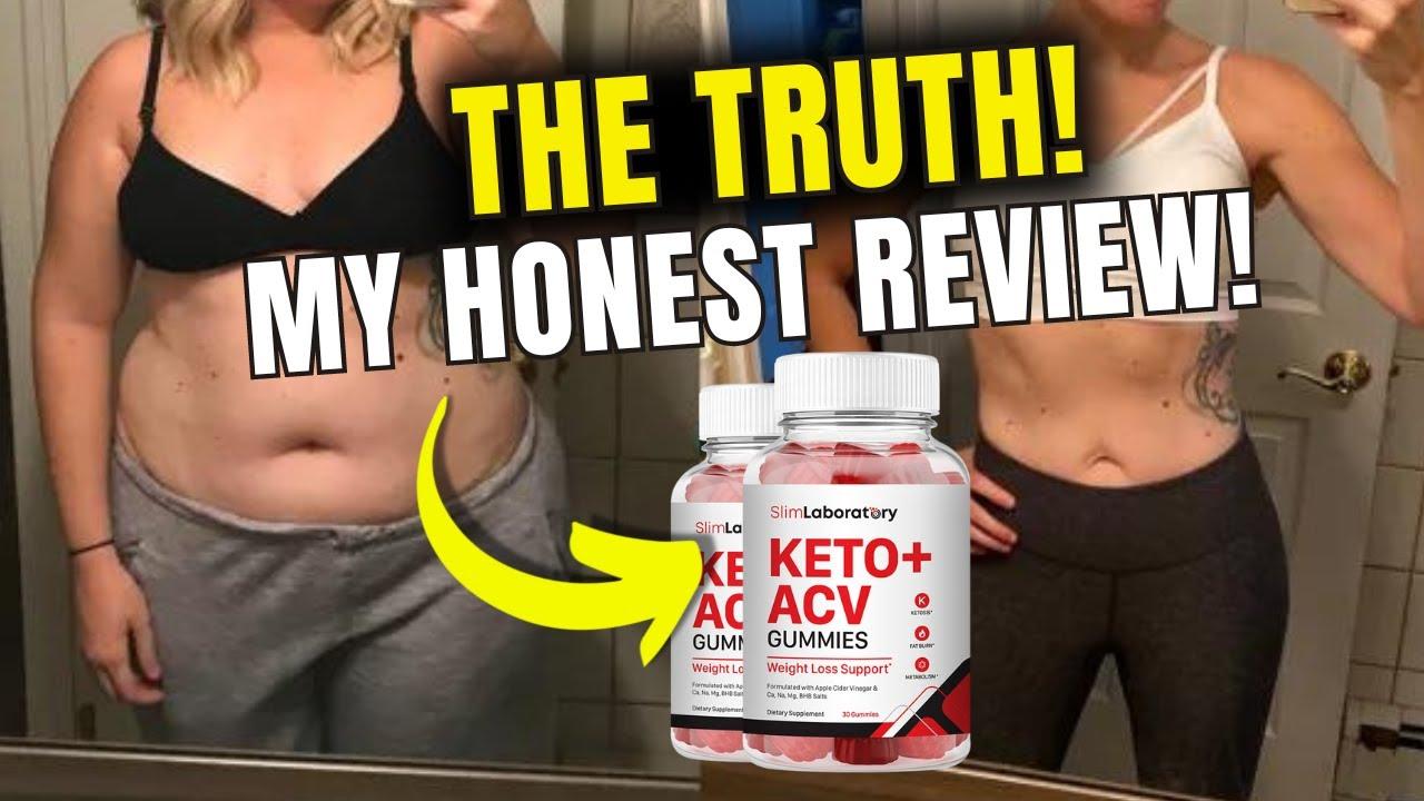 SLIM LABORATORY KETO GUMMIES REVIEWS  (THE WHOLE TRUTH) SLIM LABORATORY KETO ACV GUMMIES REVIEWS [782064653]